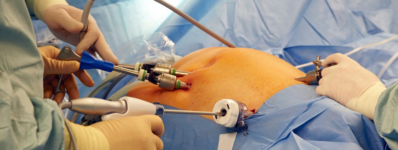 Endourology